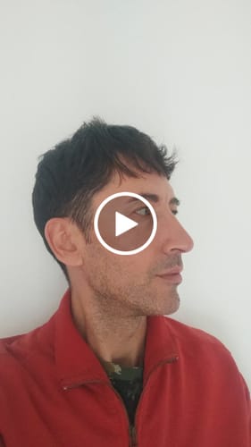 Customer video review of The Micro Infusion System™