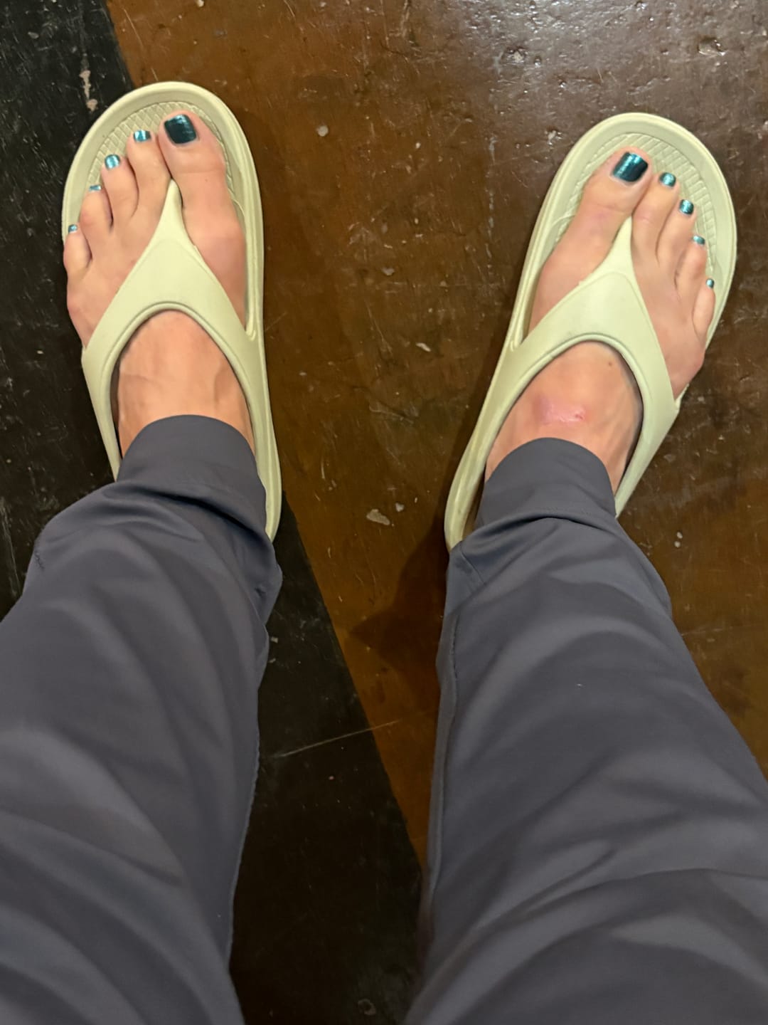 Customer photo review of Ergonomic Flip Flop with Arch Support