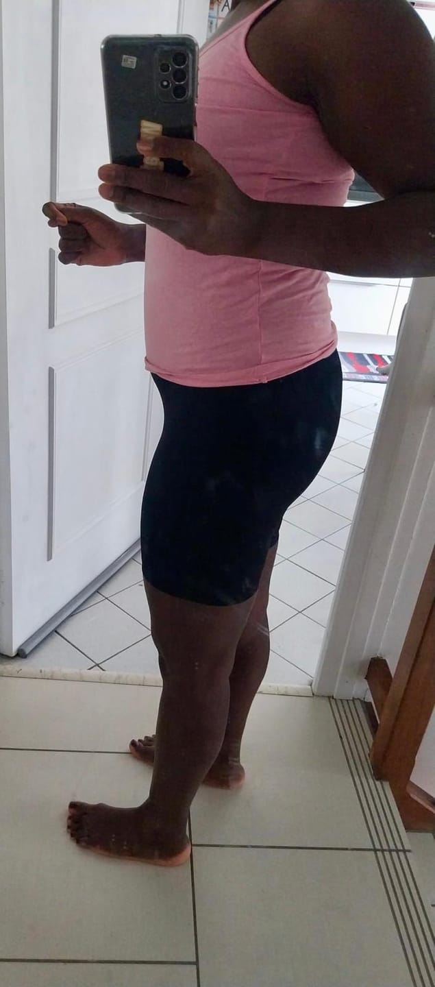 Customer photo review of Bodysuit SculptPlus Allure™
