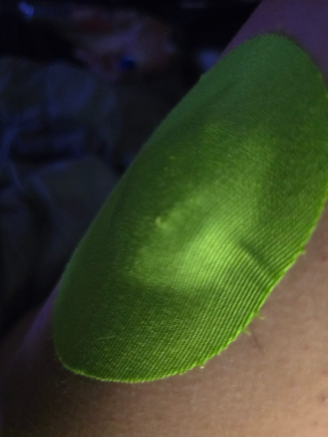 Customer photo review of Skin Grip Original - Medtronic Guardian/Enlite Adhesive Patches