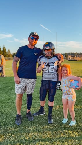 Customer photo review of Summer Compression Sleeves V2 for Knees and Legs