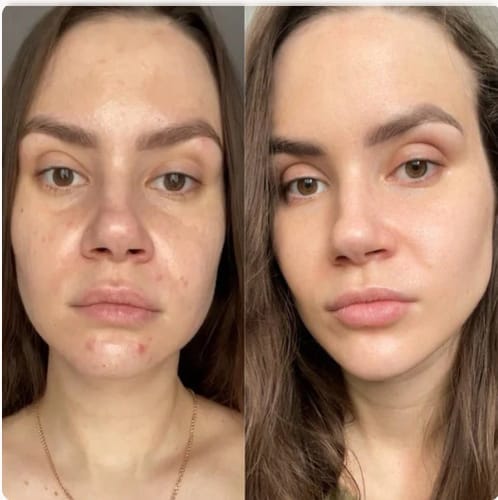Customer photo review of Retinal Shot™ – Crema Viso Anti-Rughe Rassodante