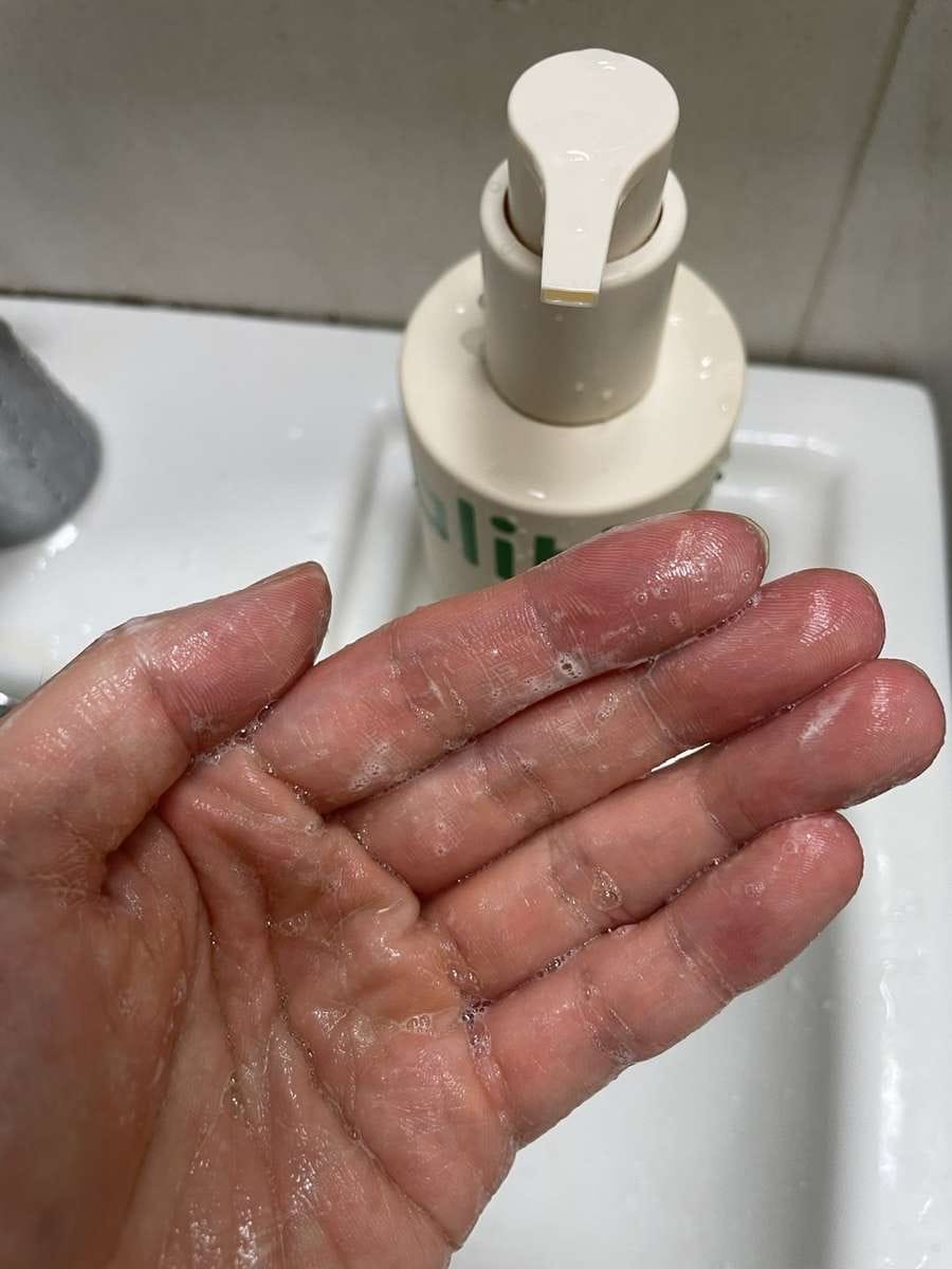 Customer photo review of HM+Barrier™ Body Cleanser