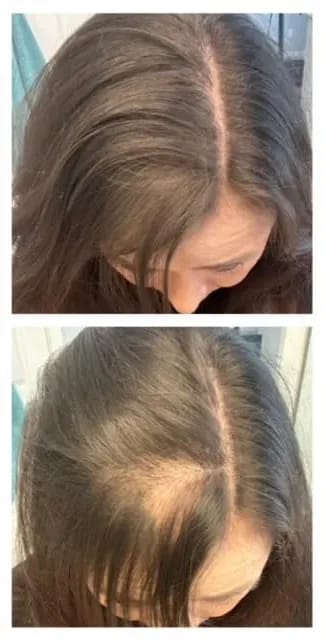 Customer photo review of ✨ Invisible Tape-In Hair Extensions | 100% Virgin Human Hair (10 PCS)