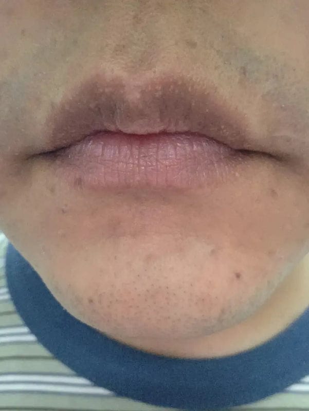Customer photo review of Lipcure Balm