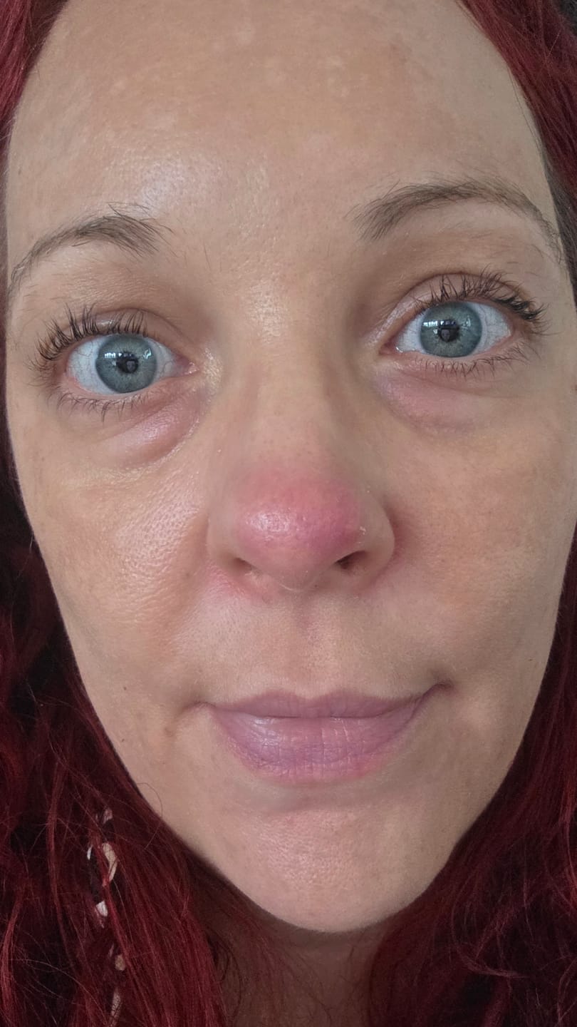 Customer photo review of SimplyLash kit