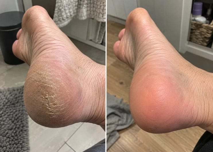 Customer photo review of Glass Foot File.