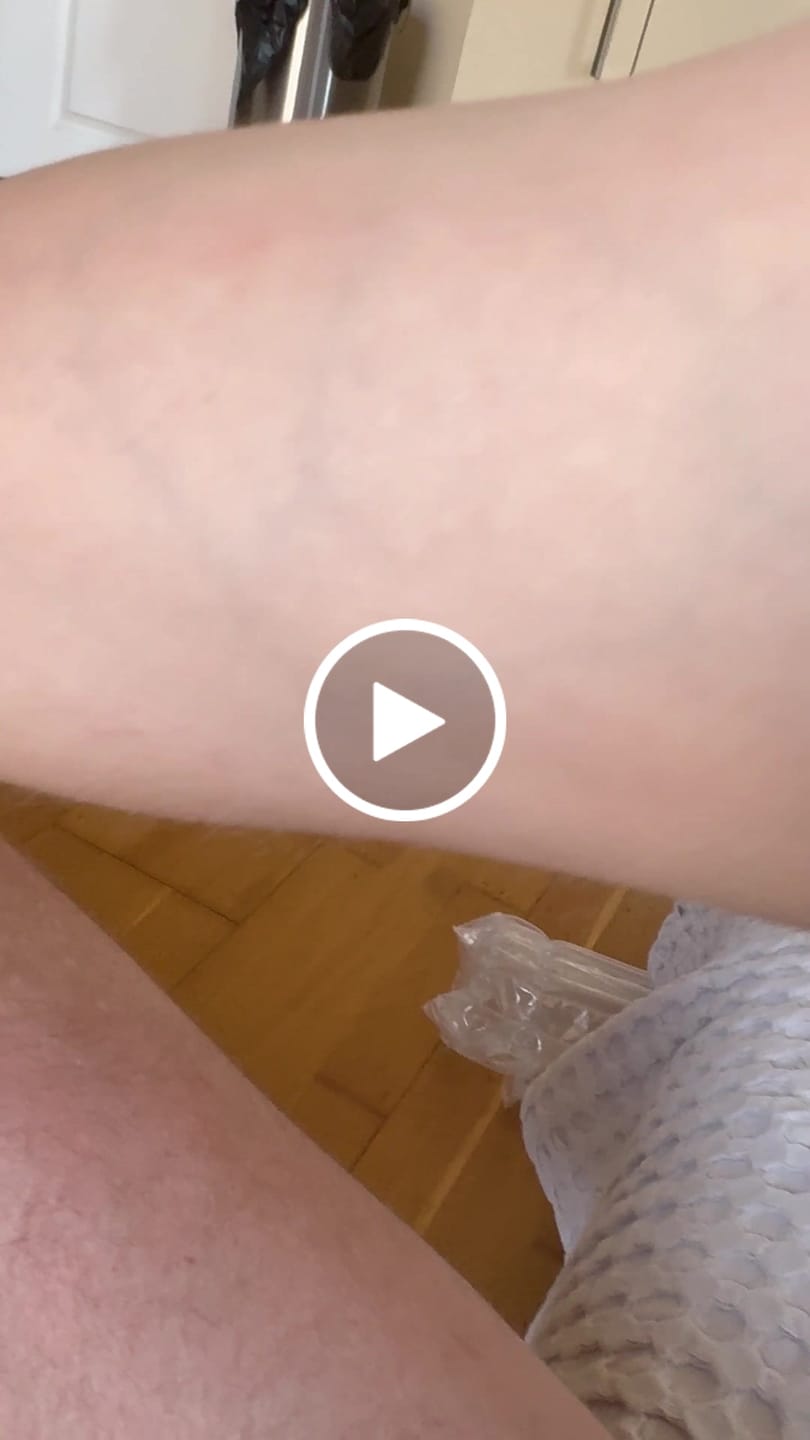 Customer video review of Skinshine
