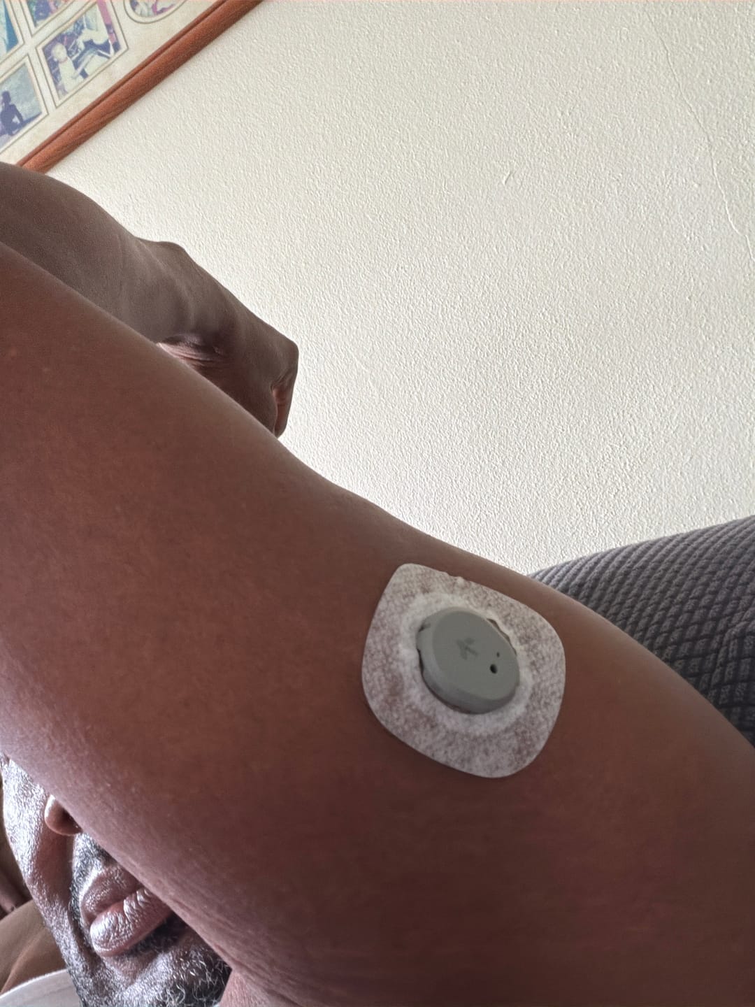 Customer photo review of Stelo By Dexcom Glucose Biosensor Kit