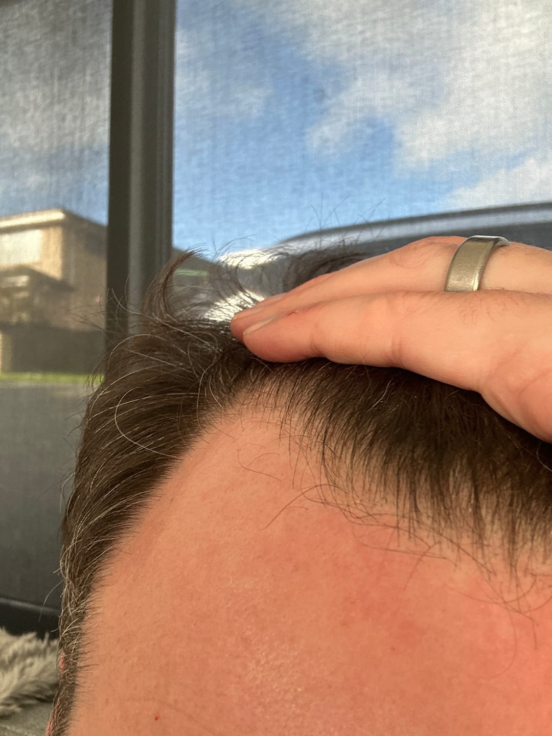 Customer photo review of Regen Hair Growth Serum