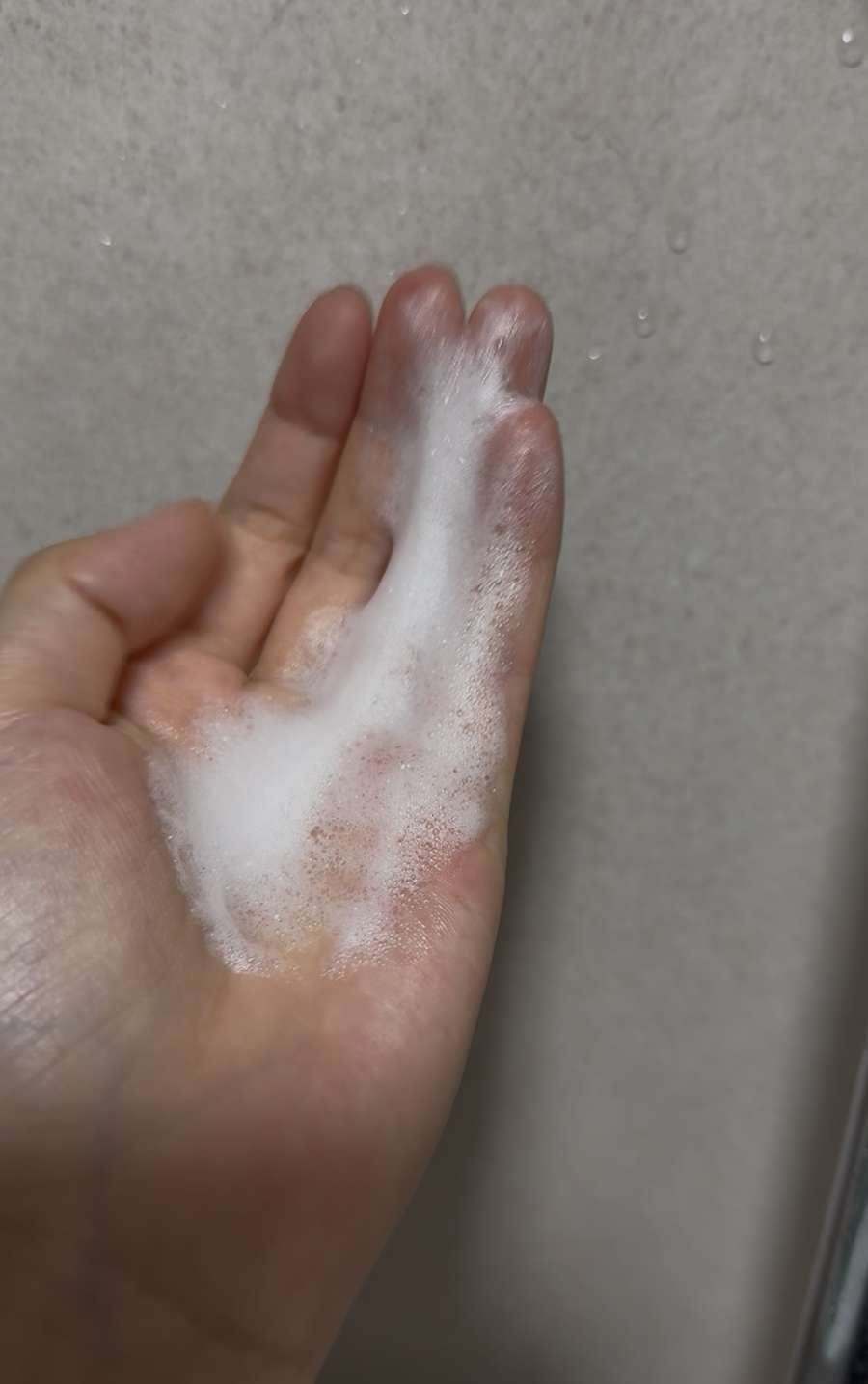 Customer photo review of HM+Barrier™ Face Cleanser