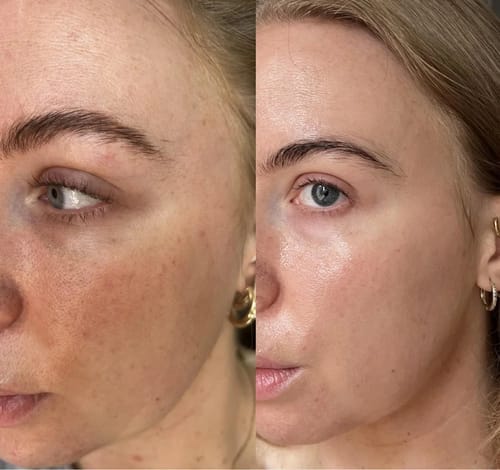 Customer photo review of Retinal Shot™ – Crema Viso Anti-Rughe Rassodante