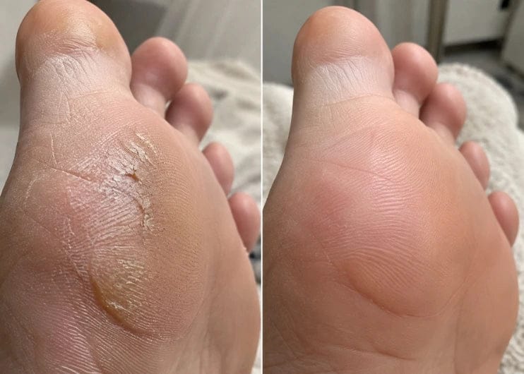 Customer photo review of Glass Foot File.