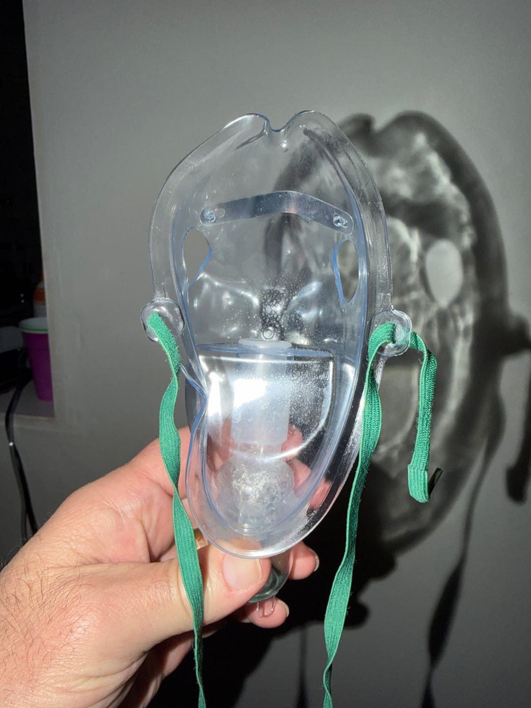 Customer photo review of Adult Nebulizer Kit with Jet Nebulizer, Aerosol Mask with 7' Tubing