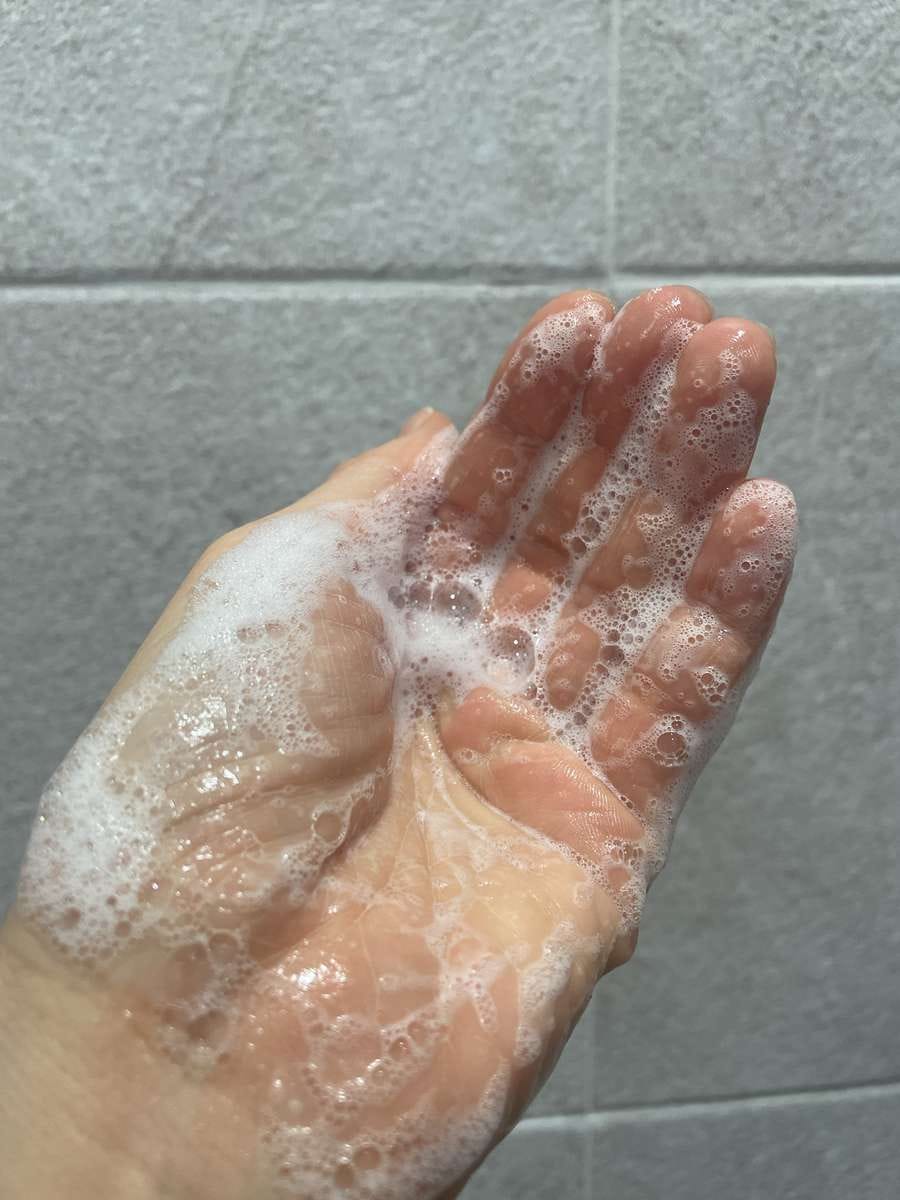 Customer photo review of HM+Barrier™ Body Cleanser