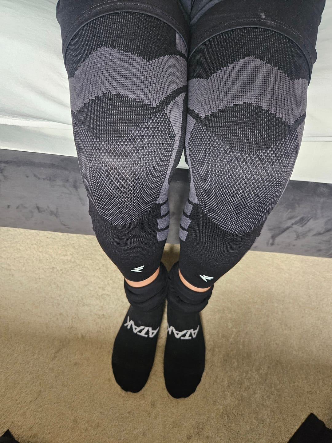 Customer photo review of Compression Sleeves V2 for Knees and Legs