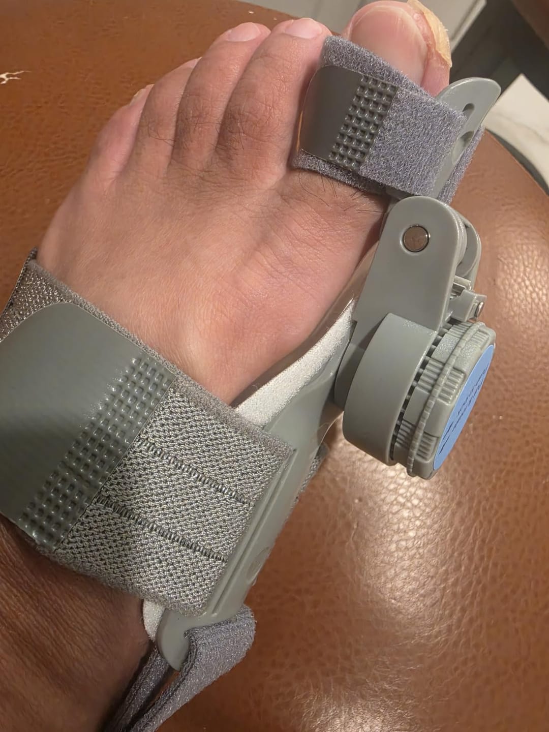 Customer photo review of FeetifFix Bunion Corrector – Adjustable Toe Alignment Support Brace (1 PCS)