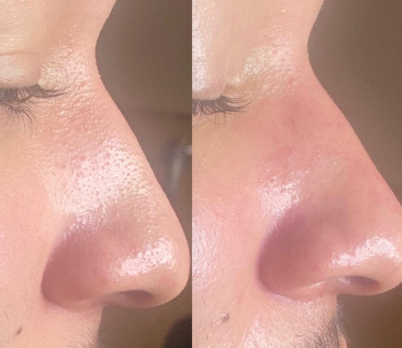 Customer photo review of Poreva