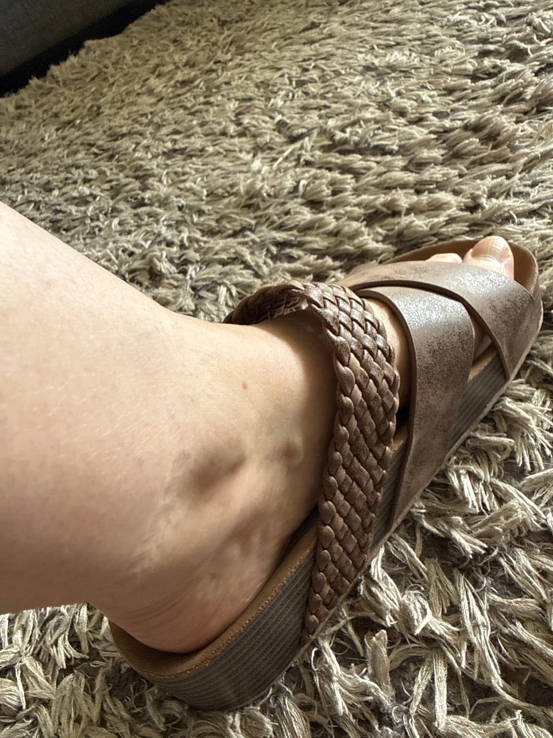 Customer photo review of Signature Sandal | Dune