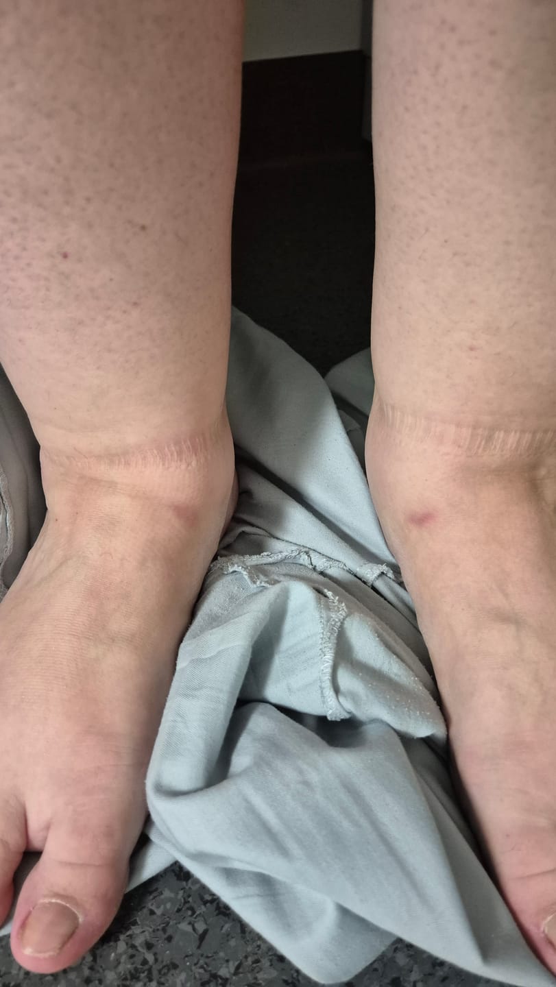 Customer photo review of Sveikatėja Kompresinės Kojinės Lengvesnėms Kojoms