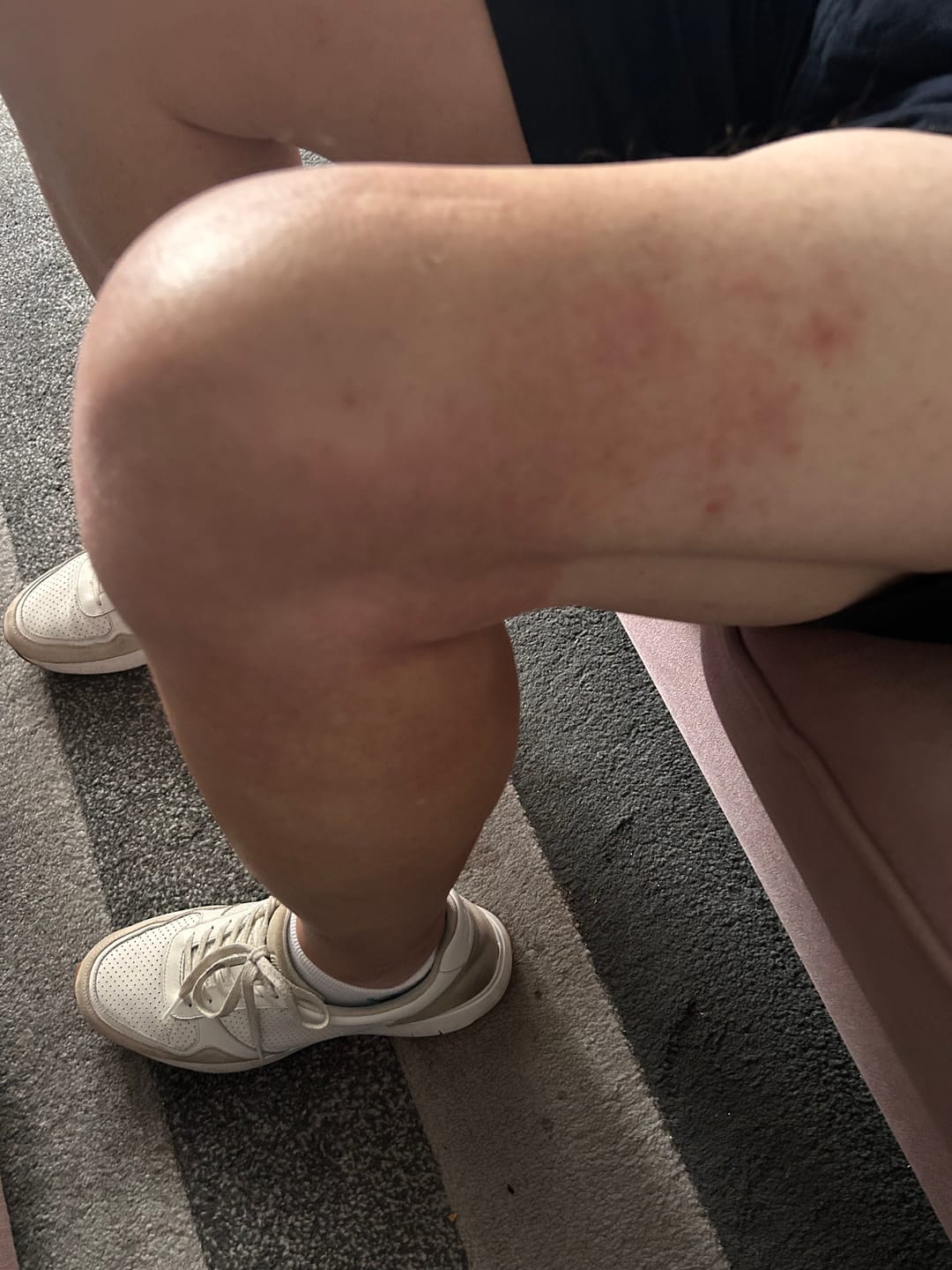 Customer photo review of Multi Strain Biotic