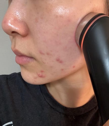 Photo d’une cliente avec le K‑Glow Booster