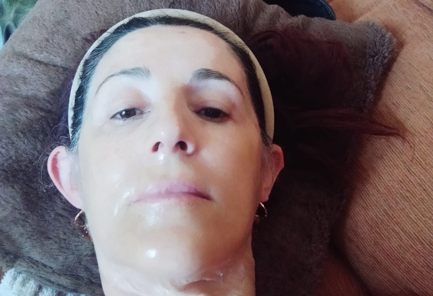 Customer photo review of Creme Anti-Manchas + Anti-Melasma Coreano Facial de Vitamina C Encapsulado - C-SPHERE CAPSULE CREAM™