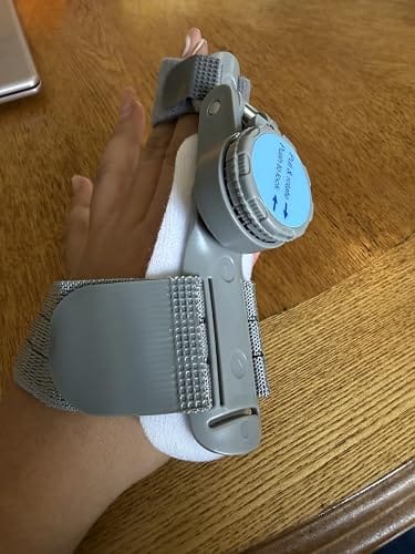 Customer photo review of FeetifFix Bunion Corrector – Adjustable Toe Alignment Support Brace (1 PCS)