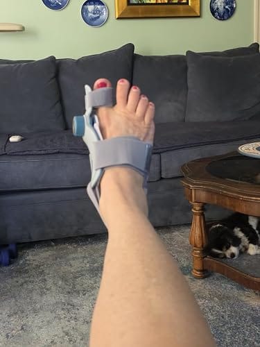 Customer photo review of FeetifFix Bunion Corrector – Adjustable Toe Alignment Support Brace (1 PCS)