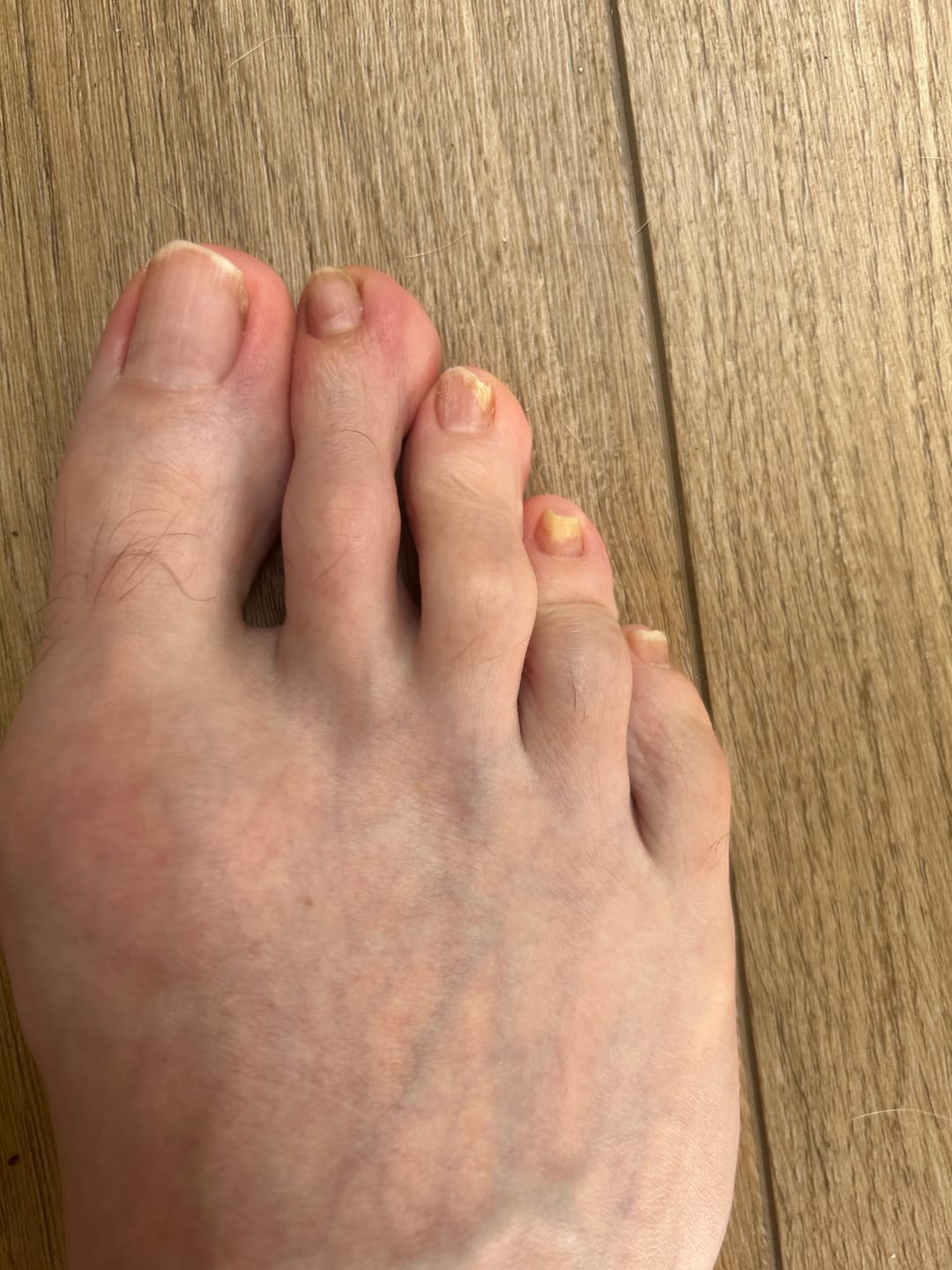Customer photo review of Fungal Freedom