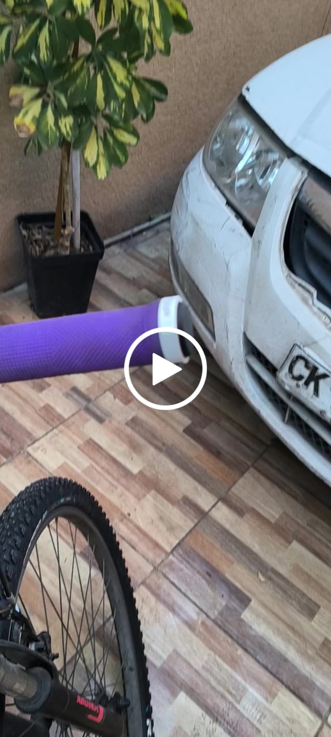 Customer video review of PUÑO TRIP LOCK PURPLE/WHITE