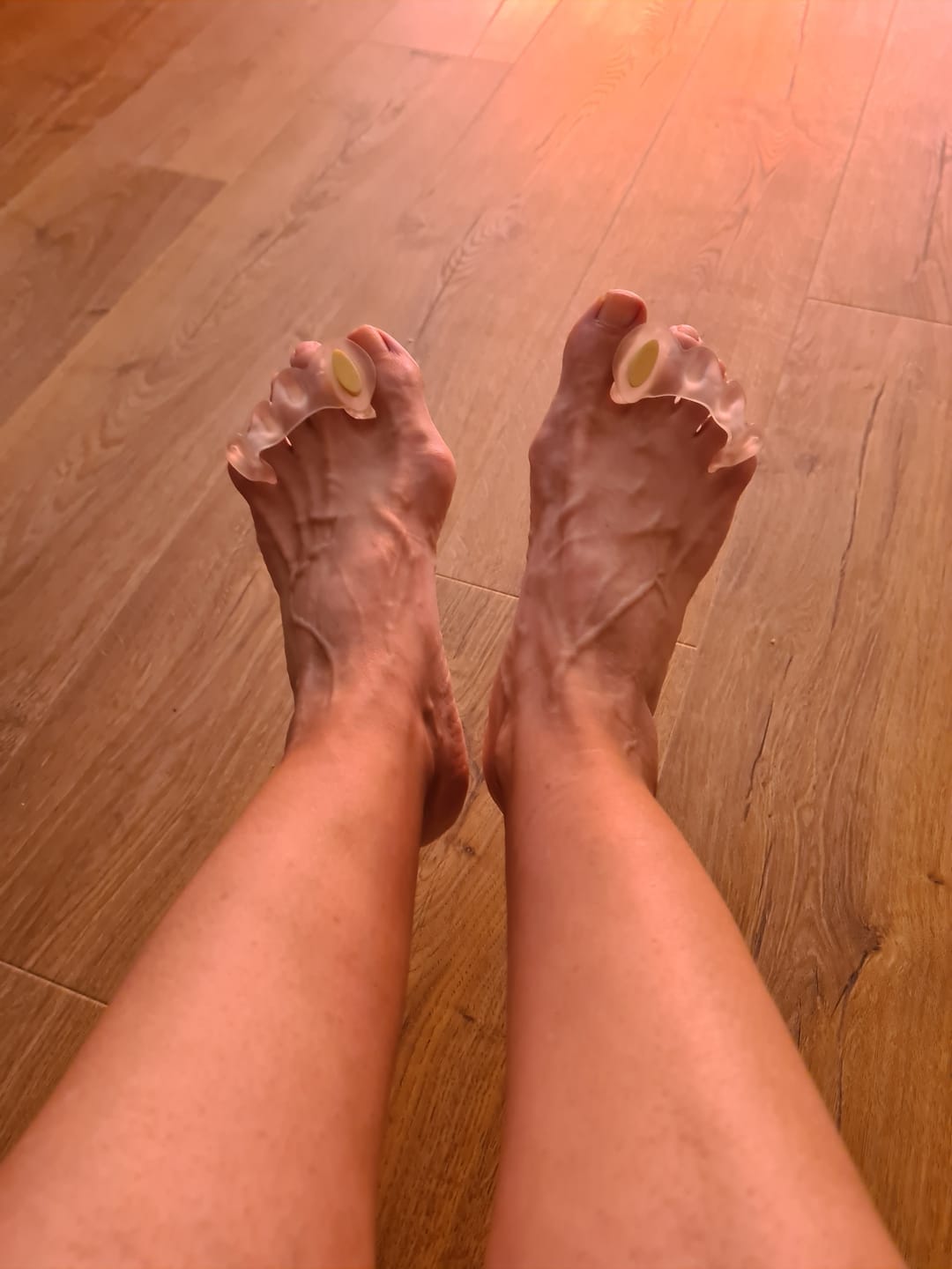 Customer photo review of Espaciadores de dedos- Soft
