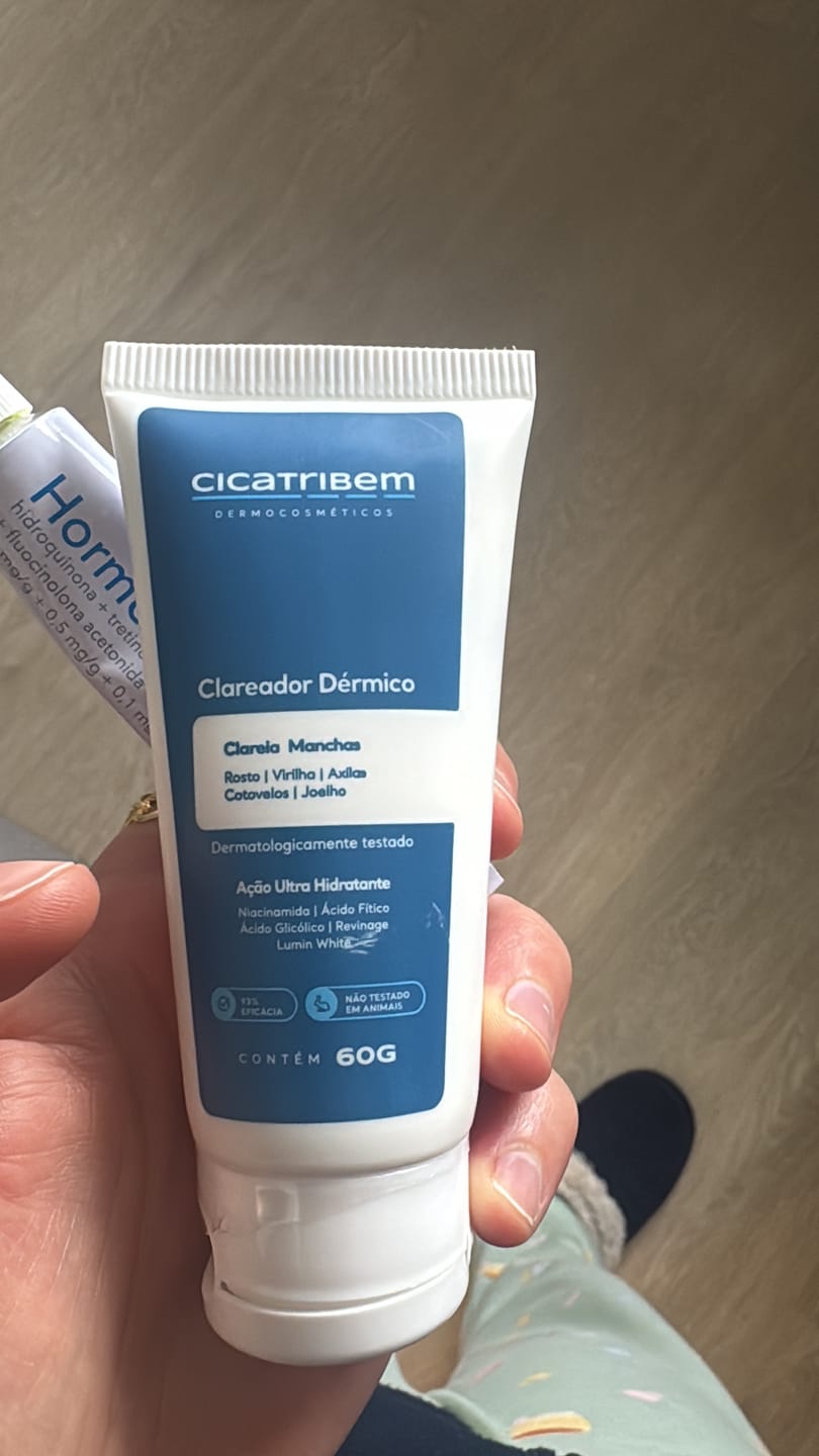 Customer photo review of Creme Clareador de Manchas – Melasma, Axilas, Virilha, Áreas Íntimas, Rosto e Corpo