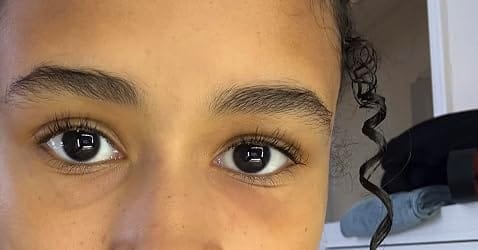 Customer photo review of Medicube Kojic Acid Turmeric Eye Serum