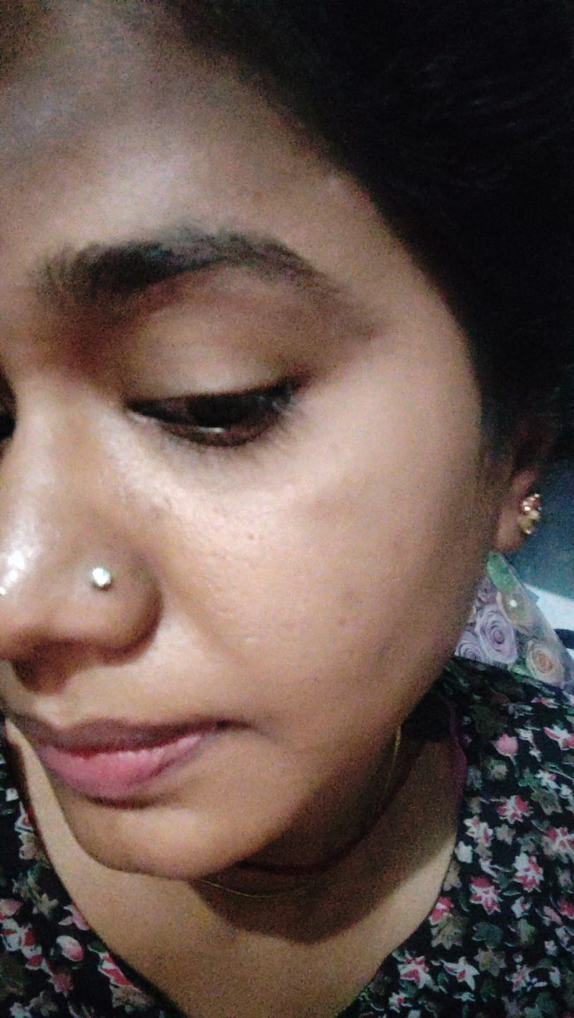 Customer photo review of GLOW BALANCE SERUM ( 50 ml )