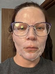 Customer photo review of PurePore™ Sheet Mask