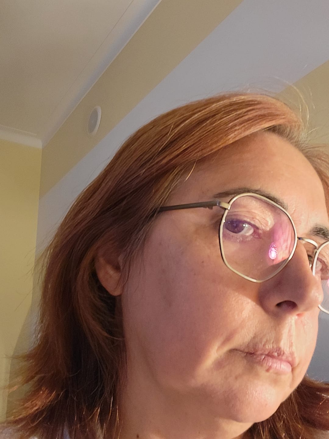 Customer photo review of Máscara Coreana de Colagénio Rejuvenescedora Peel Off - Collagen Fit™
