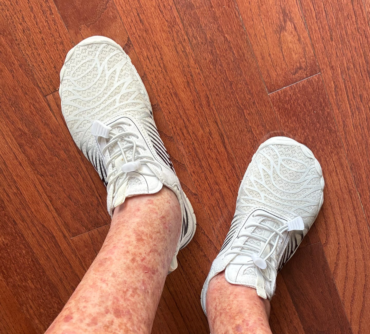 Customer photo review of Lorax Pro - Healthy & non-slip barefoot shoes (Unisex) (BOGO)
