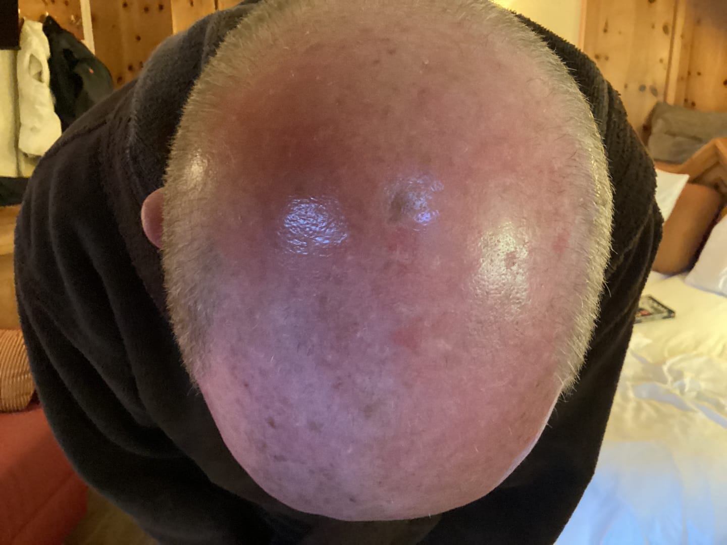 Customer photo review of Seb Natural Calming Serum