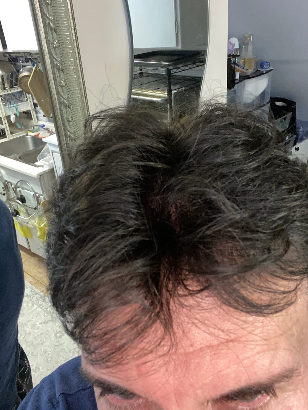 Customer photo review of 70% Ultra-light Density Ace Full french lace Men hair system