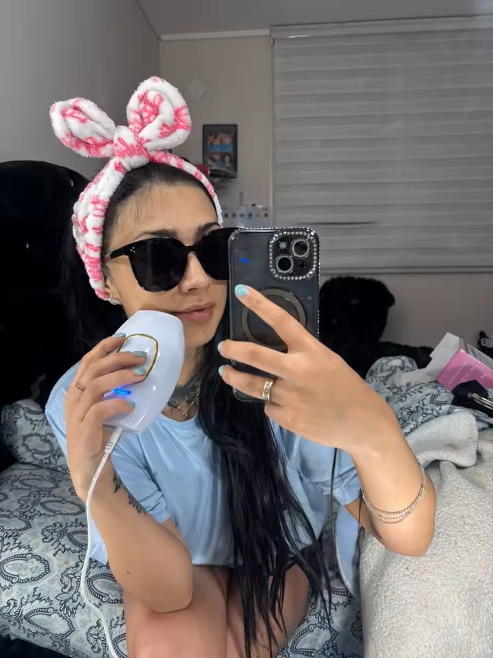 Customer photo review of Depiladora Laser IPL