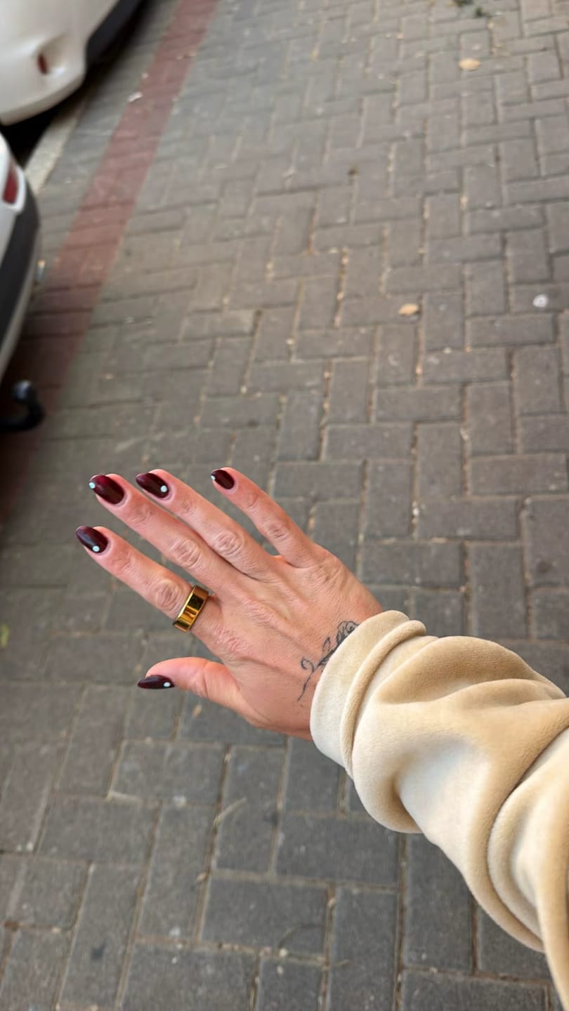 Customer photo review of BloomRing