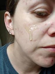 Customer photo review of DewVeil™ Hydrating Essence