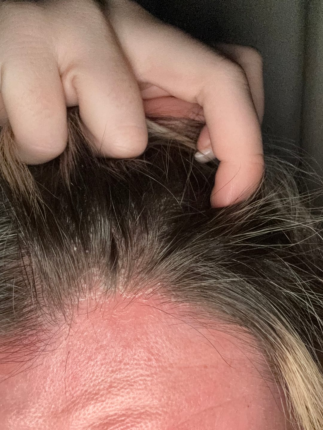 Customer photo review of Seb Natural Calming Serum
