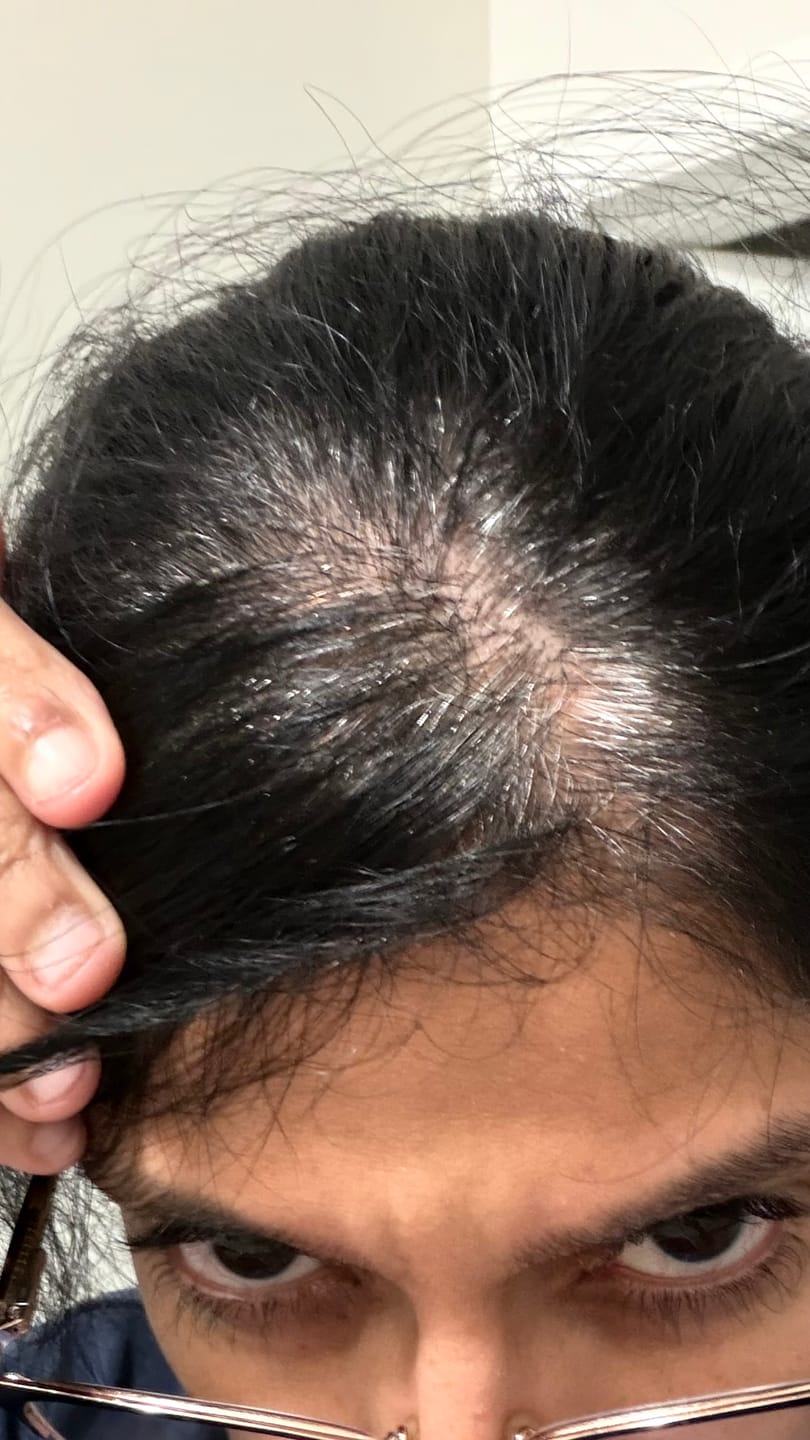 Customer photo review of Instant Dye Shampoo