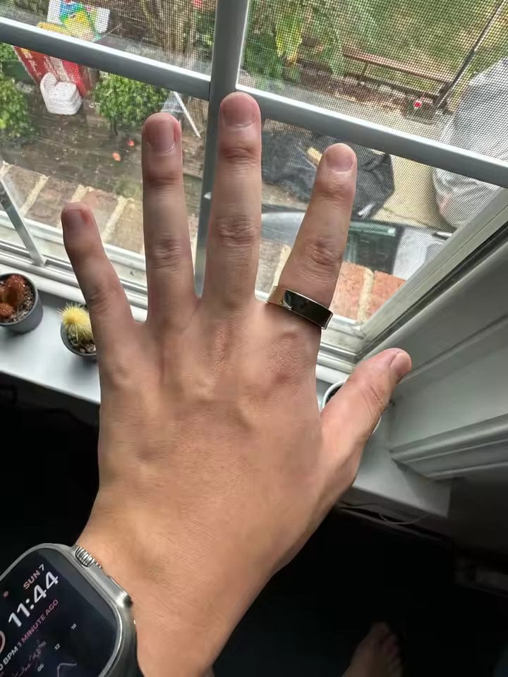 Customer photo review of BloomRing