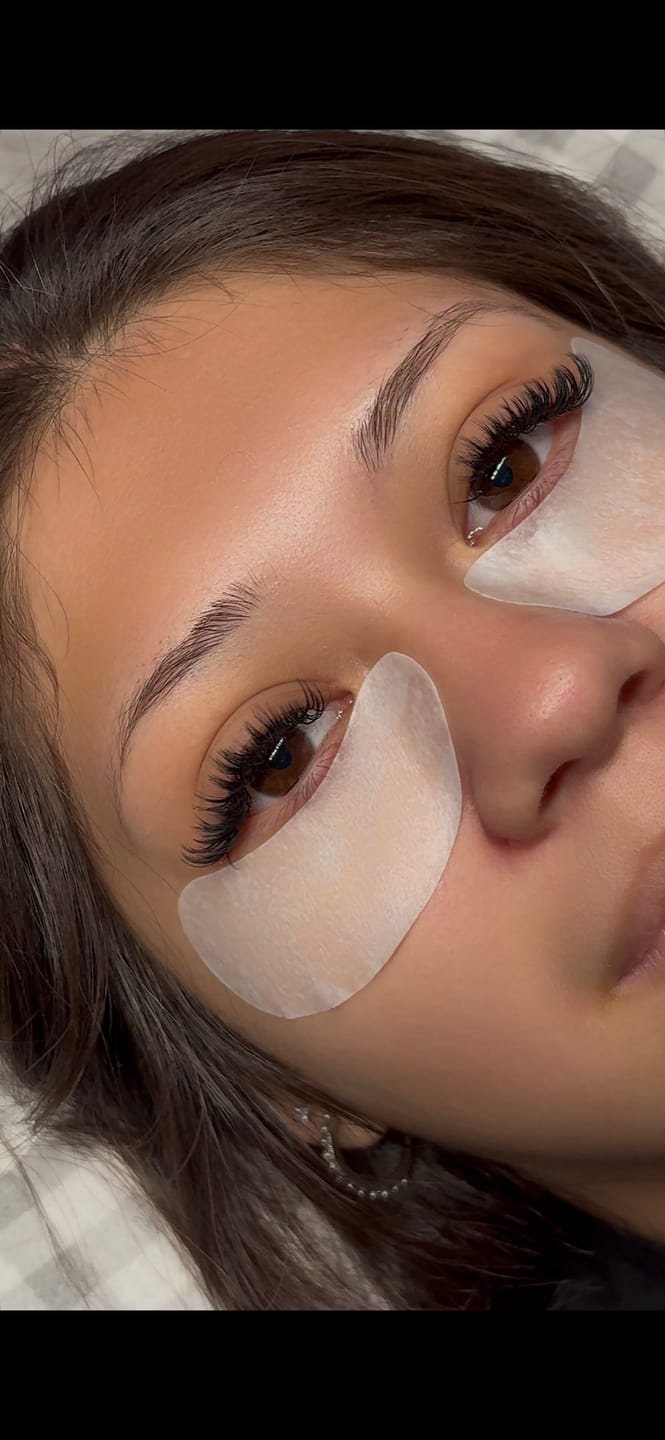 Customer photo review of 50PC Under Eye Gel Pads