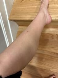 Customer photo review of LumiDew™ Skin Essence