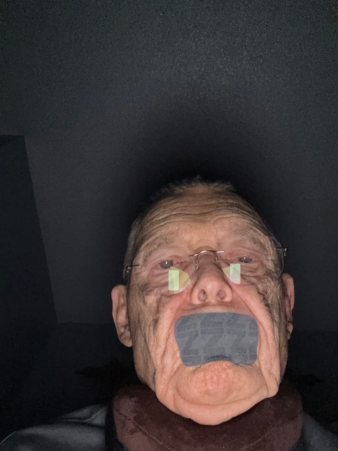 Customer photo review of ZzzTape - Mouth Tape