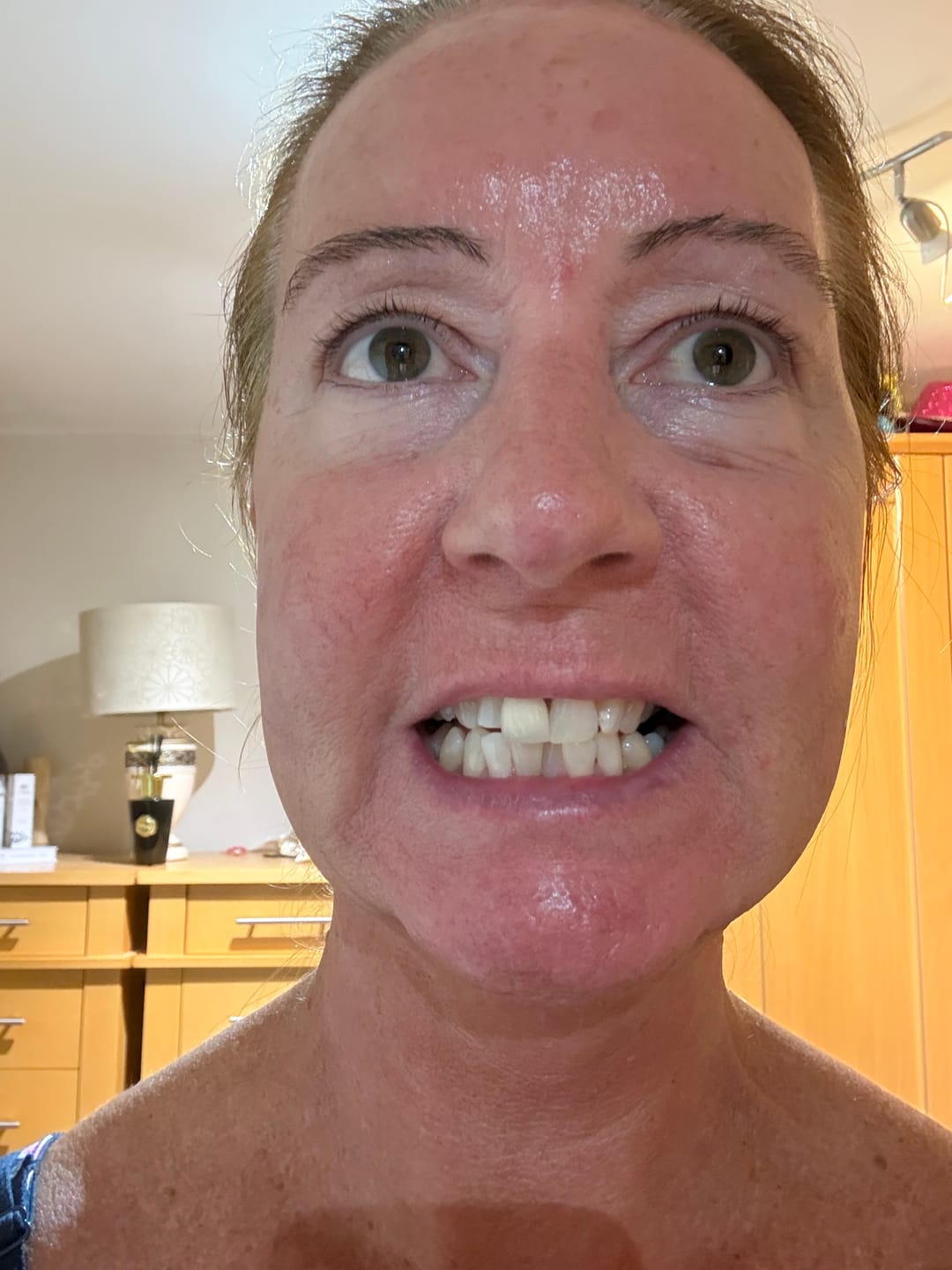 Customer photo review of Composite Care Bundle